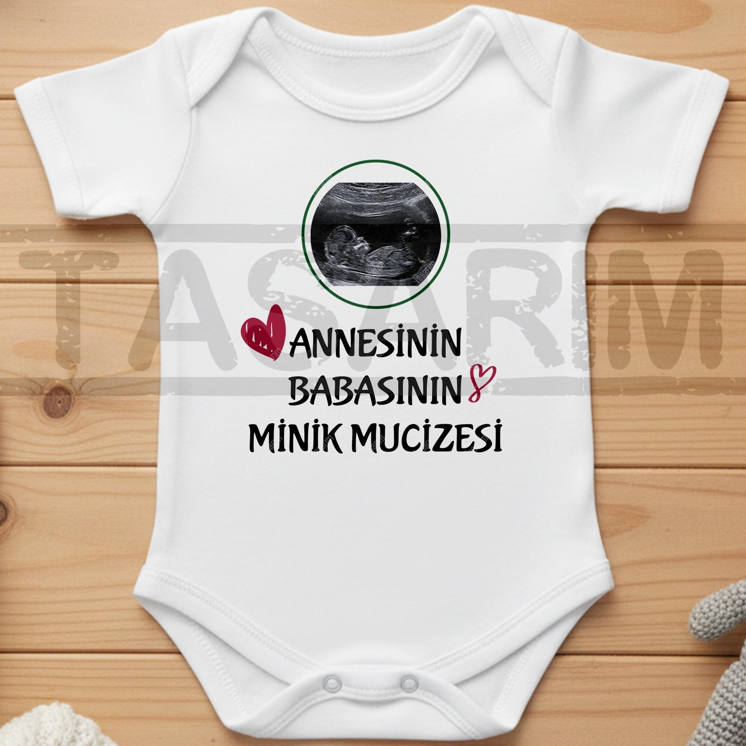 Annesinin Babasının Minik Mucizesi - Bebek Body Zıbın
