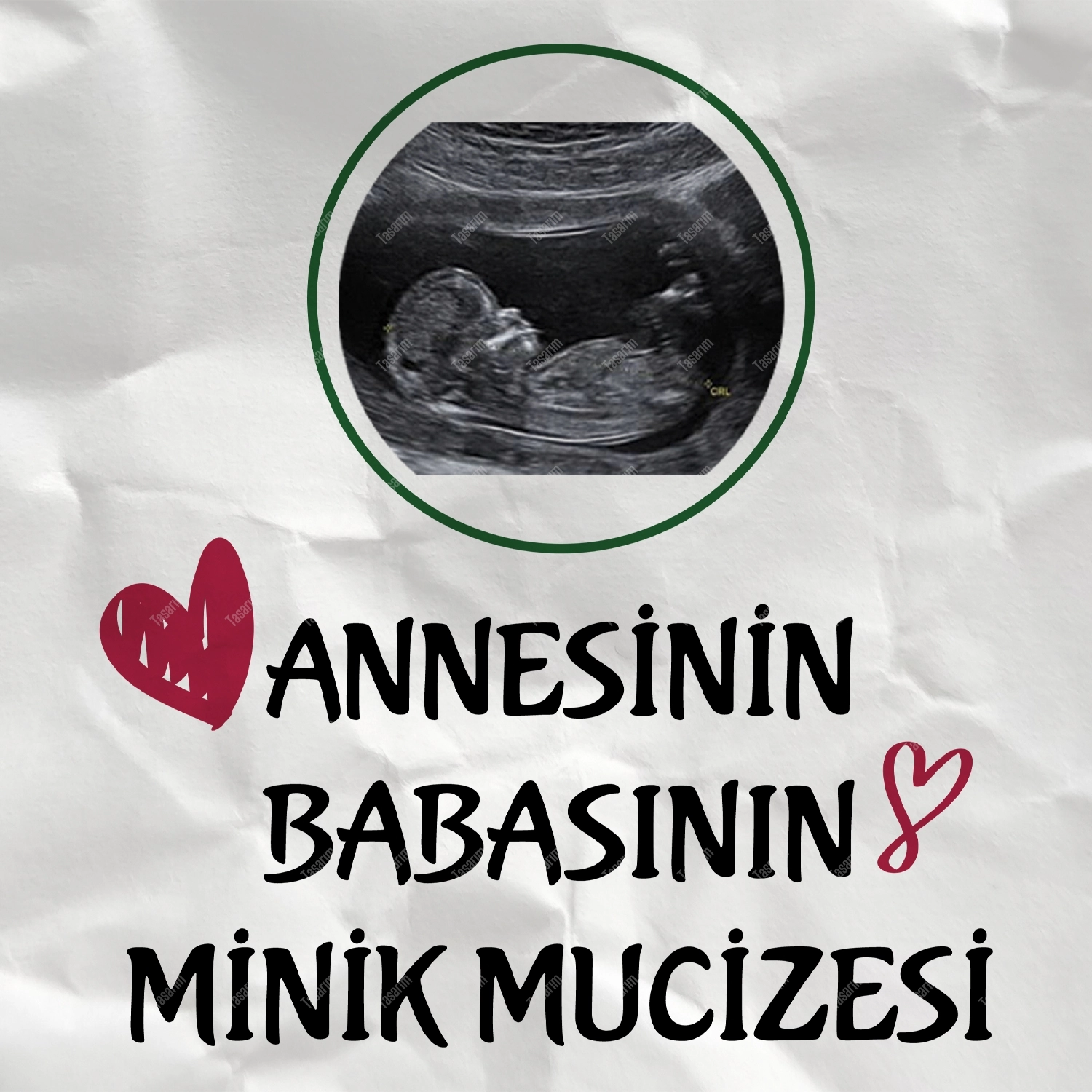 Annesinin Babasının Minik Mucizesi - Bebek Body Zıbın