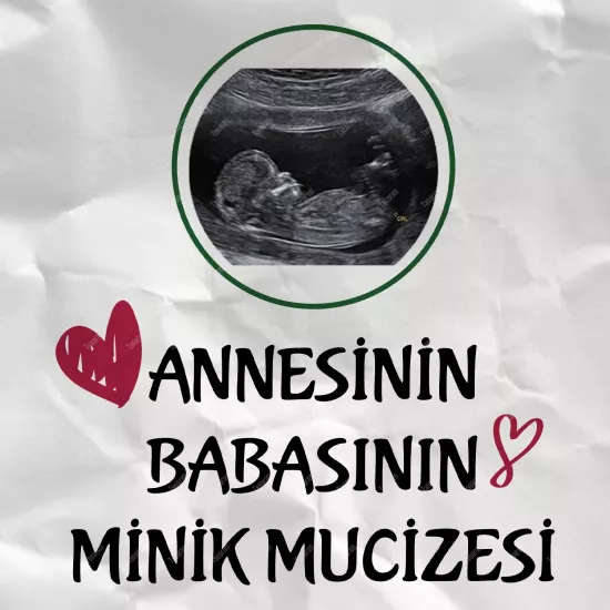 Annesinin Babasının Minik Mucizesi